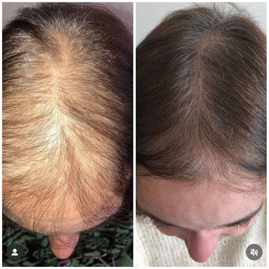 Antes y después
