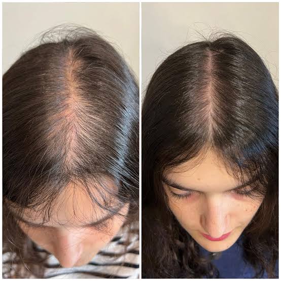 Antes y después