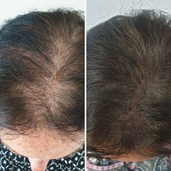 Antes y después