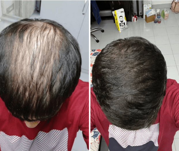 Antes y después