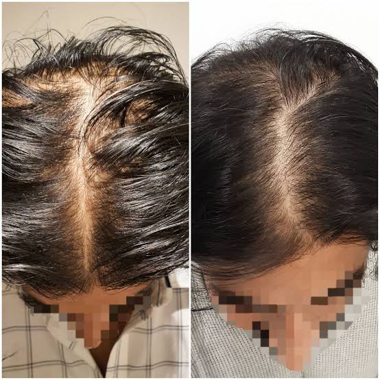 Antes y después